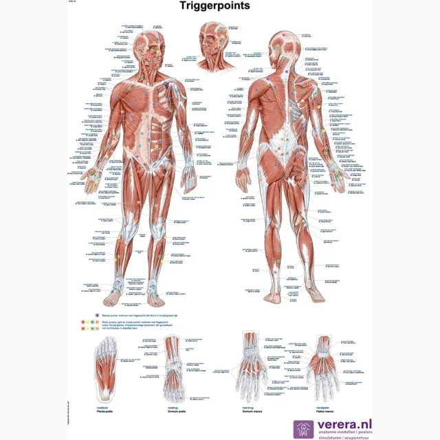 Verera.nl Anatomie poster triggerpoints (Nederlands/Latijn, papier, 50x70 cm) + ophangsysteem met ophangsysteem
