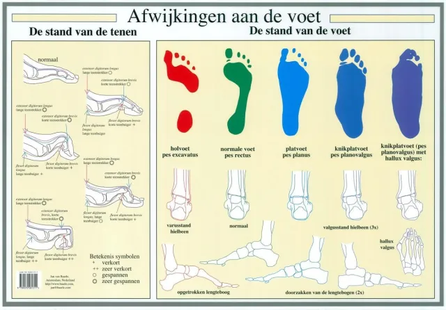 van Baarle Anatomie poster voet en voetafwijkingen (Nederlands, gelamineerd, A2)
