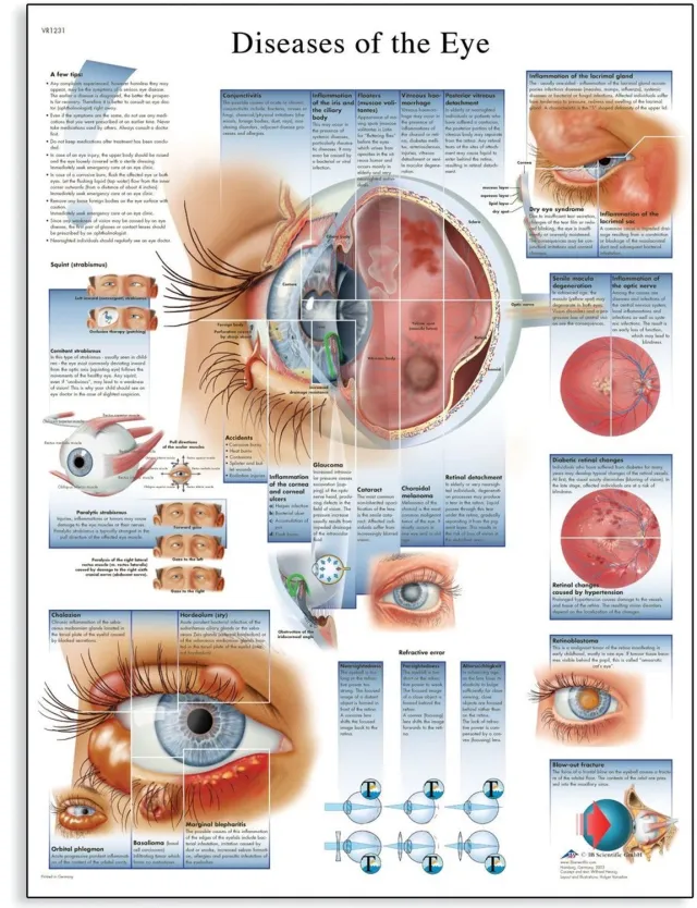 Duraxl Ziektes van het oog - Poster - 50 x 67 cm - Glanzend Veelkleurig