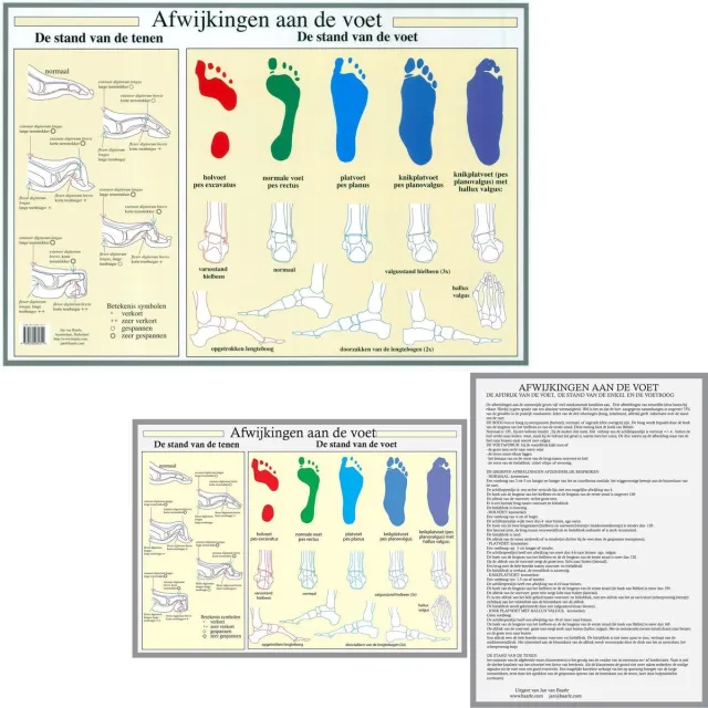 van Baarle Het menselijk lichaam - anatomie poster voet en voetafwijkingen (Nederlands, gelamineerd, A2 + A4) nvt